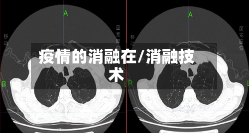 疫情的消融在/消融技术-第2张图片