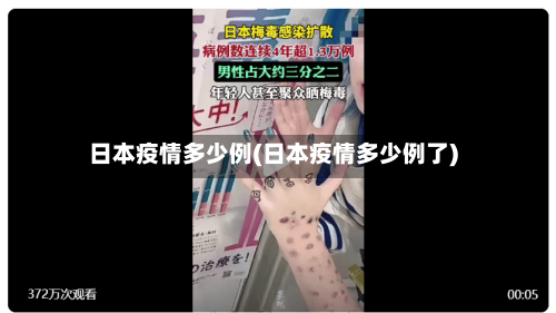 日本疫情多少例(日本疫情多少例了)-第3张图片
