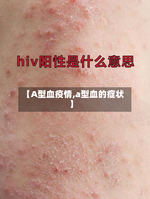 【A型血疫情,a型血的症状】-第2张图片