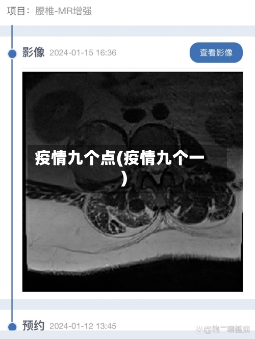 疫情九个点(疫情九个一)