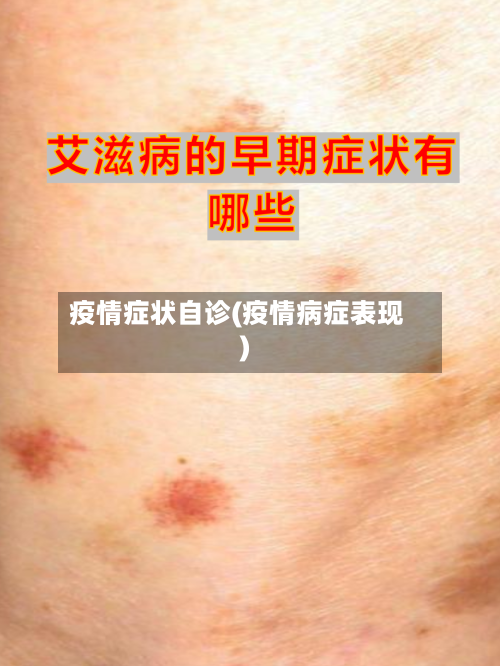 疫情症状自诊(疫情病症表现)-第2张图片