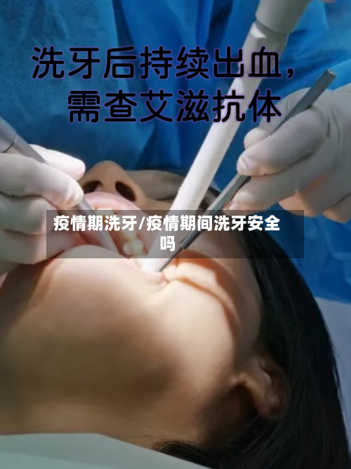 疫情期洗牙/疫情期间洗牙安全吗