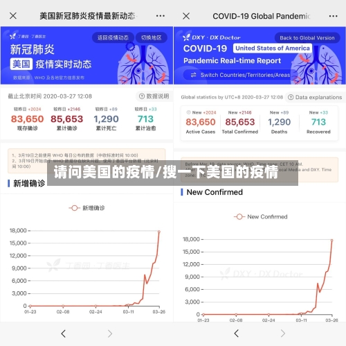 请问美国的疫情/搜一下美国的疫情