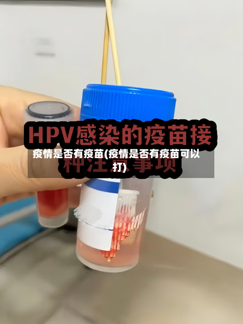 疫情是否有疫苗(疫情是否有疫苗可以打)