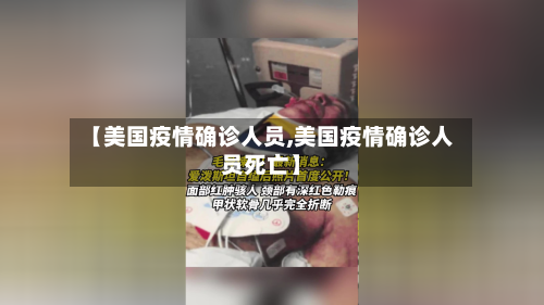 【美国疫情确诊人员,美国疫情确诊人员死亡】